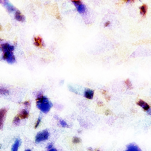 荷兰肉体裸交做爰视频
